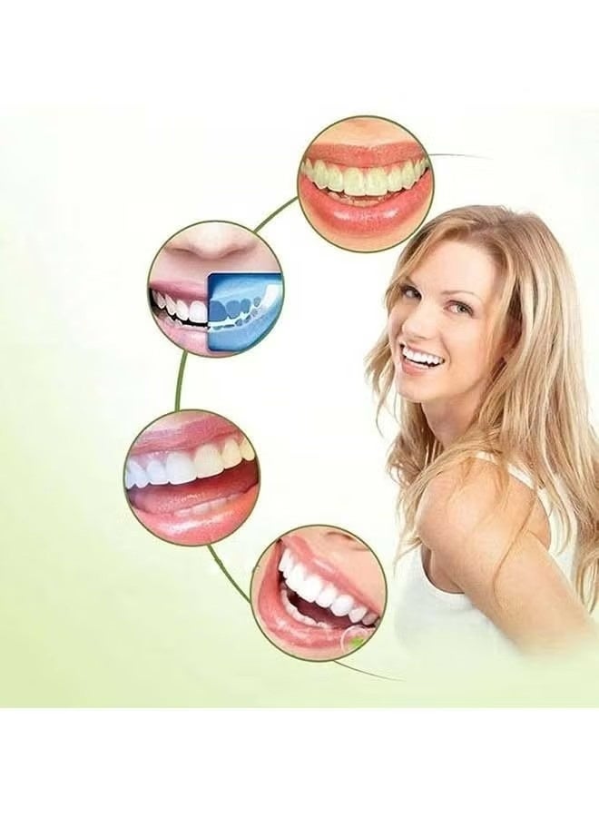 Crazylife Teeth Veneers, Denture Occlusal Veneer For Upper And Lower Jaw Dentures, No Pain No Shot No Drilling, Natural And Comfortable, Protecting Teeth, Restoring Confidence Smiling - Image 2